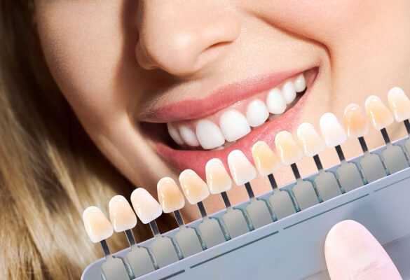 Antalya Ortodonti Ve Estetik Diş Hekimliği